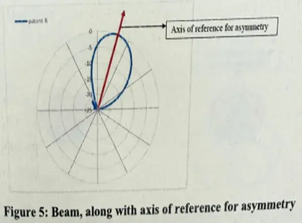 Reference of Assymetry