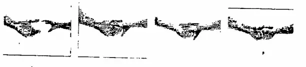 Device of Hands Mark TM